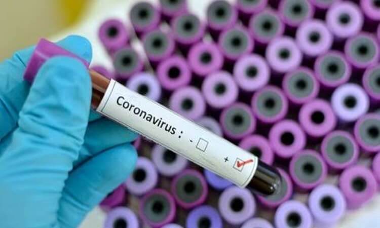 langkah-langkah dan cara mencegah virus corona yang menular